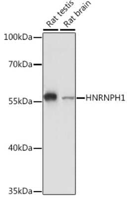 Western Blot: hnRNP H Antibody [NBP2-93590] - Western blot analysis of extracts of various cell lines, using hnRNP H Rabbit pAb (NBP2-93590) at 1:3000 dilution. Secondary antibody: HRP Goat Anti-Rabbit IgG (H+L) at 1:10000 dilution. Lysates/proteins: 25ug per lane. Blocking buffer: 3% nonfat dry milk in TBST. Detection: ECL Basic Kit. Exposure time: 90s.